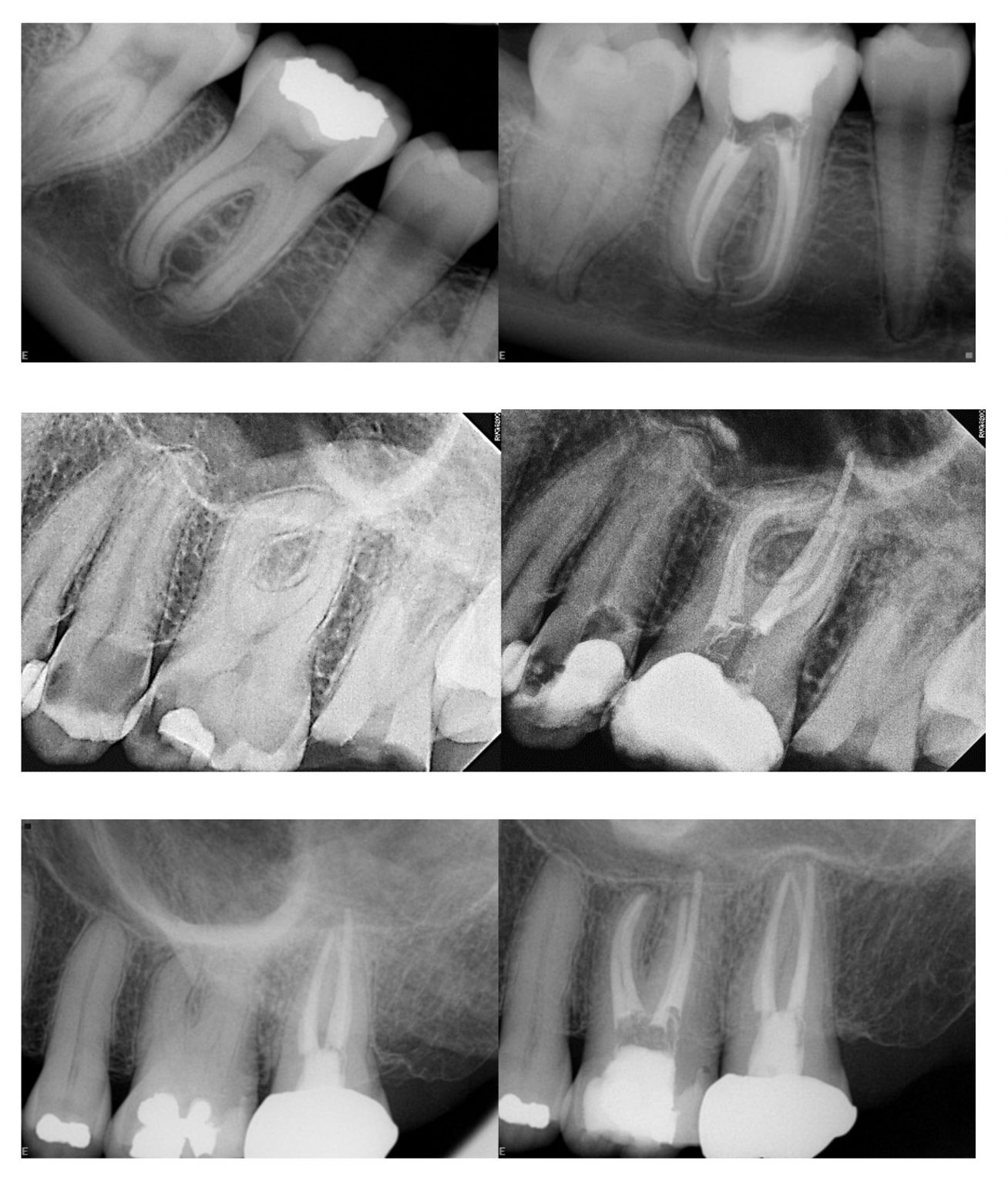 Our Technology Modern Endodontics PA