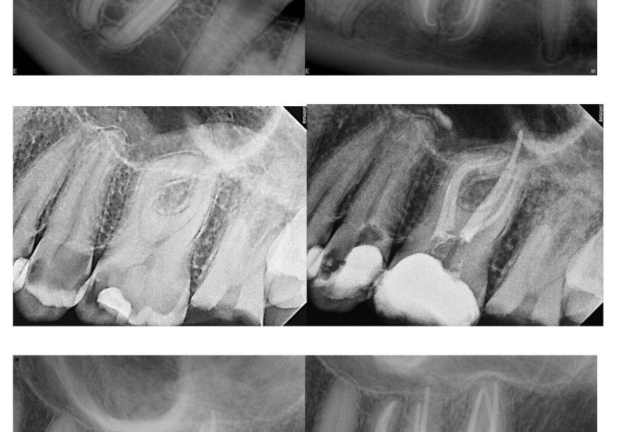 to Modern Endodontics PA